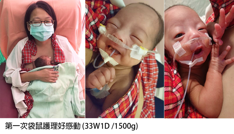 早產寶寶進行袋鼠護理後的親密親子互動